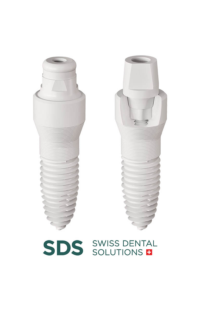 Keramikimplantate von Swiss Dental Solutions